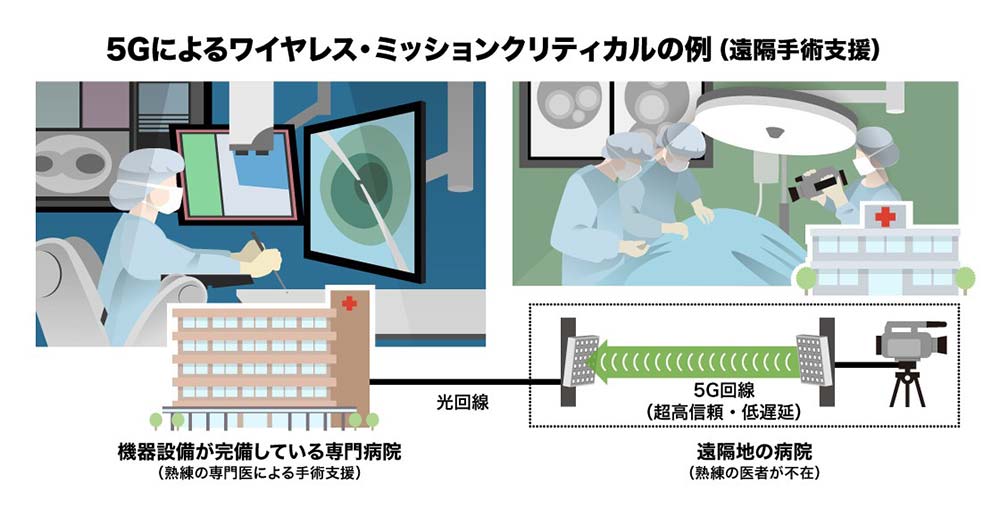 5Gによるワイヤレス・ミッションクリティカルの例（遠隔手術支援）