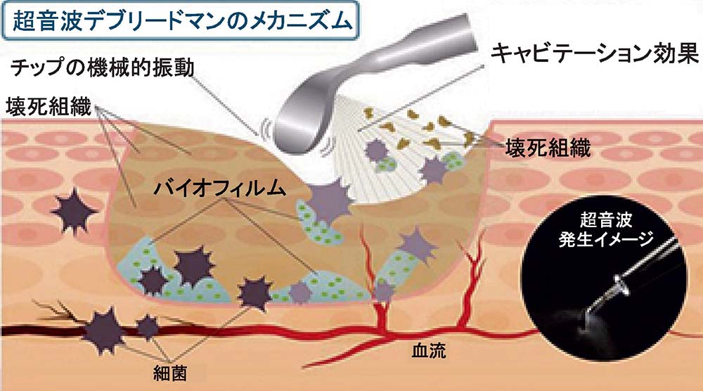 口蹄疫の前後であなたの口はどのように変化しますか?