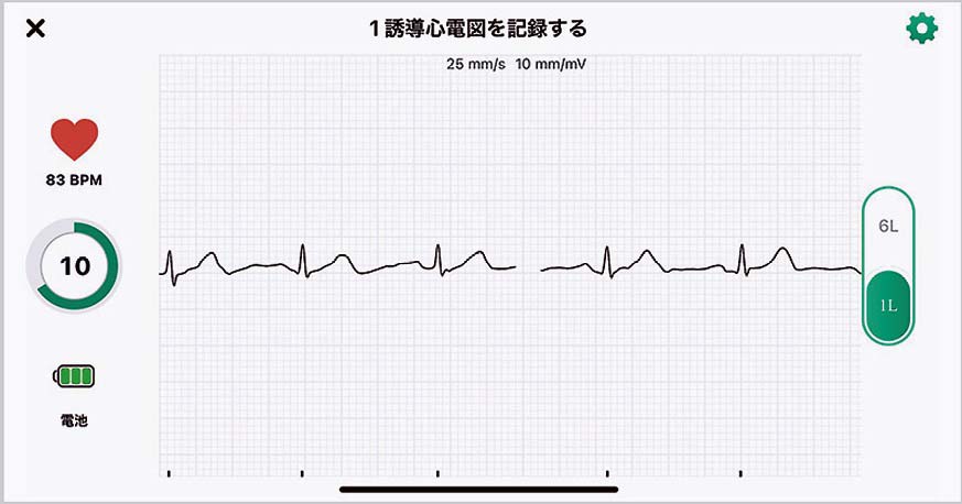 心電図のイメージ