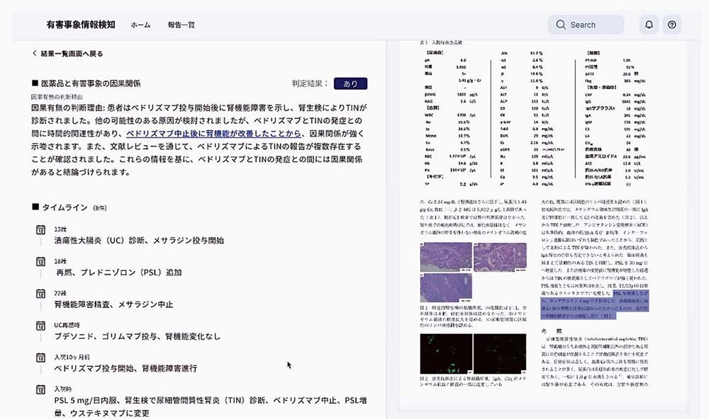 生成AIを活用した有害事象情報検知の画面イメージ