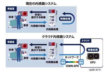 NTTとオリンパスが世界初の内視鏡システム実証　APN使いクラウドで映像処理