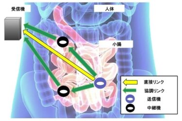 大阪公立大、生体内通信を支える新技術開発　飲み込み型医療機器の導入後押し　
